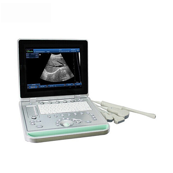 3D full digital imaging laptop ultrasound b scanner , portable ultrasound scanner